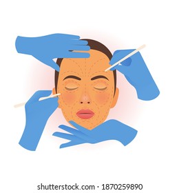 Cosmetic Surgery. Plastic and Aesthetic. Surgical Cosmetic Procedure. Female Face with Dotted Lines, Hands Wearing Surgical Blue Gloves Isolated on White Background. Website Template. 