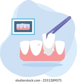 Dientes cosméticos Concepto de tratamiento de carillas, Corona de dientes o puente de tapa Diseño híbrido Puente dental Diseño de Vector de color de diseño, Símbolo de odontología, Signo de atención médica, Instrumento dental Ilustración de stock