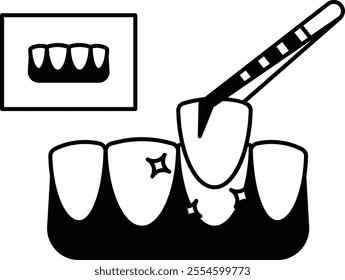 cosmetic teeth Veneers treatment concept, Tooth crown or cap bridge Hybrid Designed Dental Bridge vector outline design, Odontology symbol, manual dexterity sign Dentist tools stock illustration