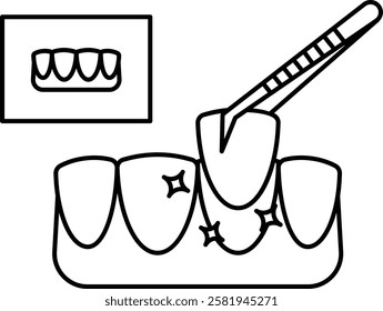 cosmetic teeth Veneers treatment concept, Tooth crown or cap bridge Hybrid Designed Dental Bridge vector icon design, Dentistry symbol, Healthcare sign, Dental instrument illustration