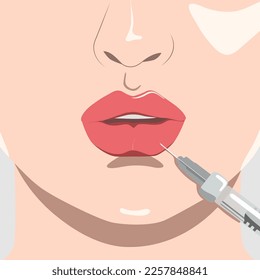 Kosmetologe macht Lippenvergrößerung einer schönen Frau. Kosmetologie und professionelle Hautpflege. Illustration