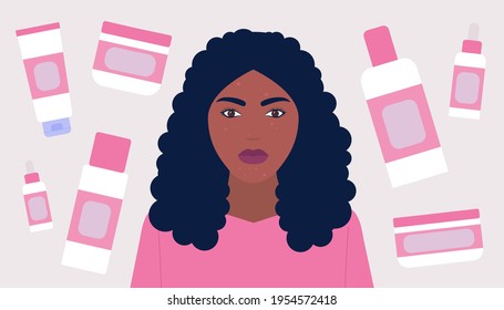 Cosmetology, dermatology concept. Young woman has skin problems. Colorful flat vector illustration