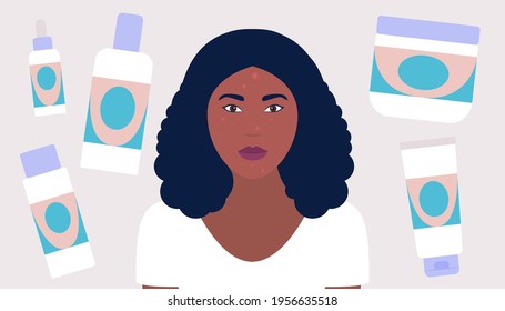 Cosmetology, dermatology concept. Young woman has skin problems. Colorful flat vector illustration
