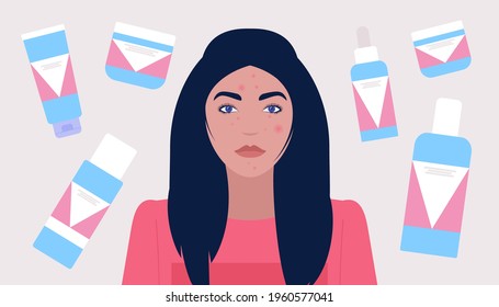 Cosmetology, dermatology concept. Young woman has skin problems. Colorful flat vector illustration