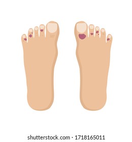 Covid Toe Trash Corona Virus Symptoms Flat Icon Vector Illustration