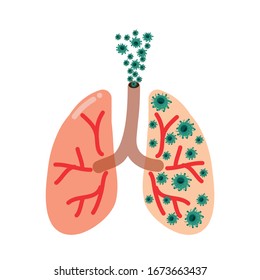 Covid-19 or Coronavirus eating human lung.