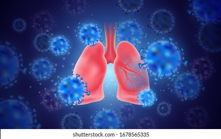 Covid-19, Coronaviruses In The Lung. China Pathogen Respiratory Influenza Covid Virus Cells.