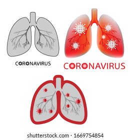 Covid-19. Human lungs vector illustration. Sars disease, coronaviruses in the lung. The coronavirus causes the severe illness SARS. 