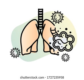 Covid-19 Impact on Human Lungs - PULMONARY EDEMA - Illustration as EPS 10 File