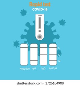 
COVID-19 laboratory rapid test for diagnosis of viral infection is ready for Coronavirus (COVID-19) screening IgM / IgG diagnostic test of covid-19 IGM / IGG antibodies in the microbiological lab. 