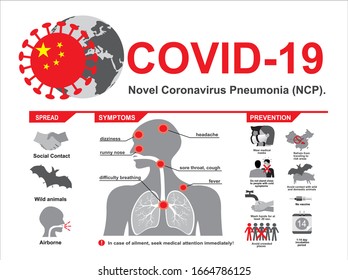 COVID-19. Novel Coronavirus. 2019-nCoV disease prevention infographic with icons and text, healthcare and medicine concept. Flu spreading of world, SARS pandemic risk alert. Vector.