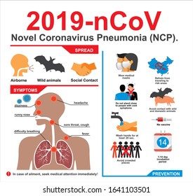 Covid-19. Novel Coronavirus Pneumonia (NCP). 2019-nCoV disease prevention infographic with icons and text, healthcare and medicine concept. Flu spreading of world, SARS pandemic risk alert. Vector.