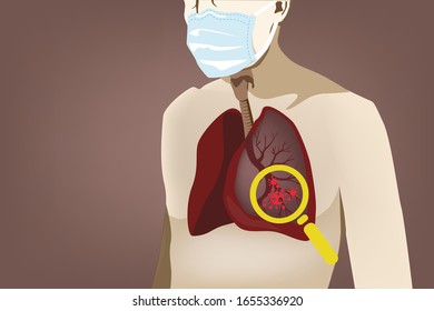 COVID-19 is primarily spread between people by small droplets from infected individuals when they breathe or cough. People may have few symptoms or develop fever, cough, and shortness of breath.