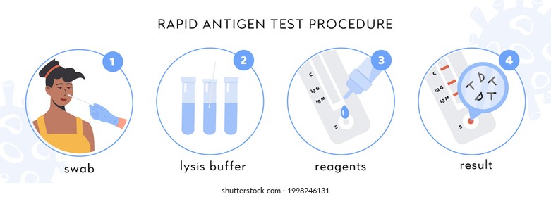 Covid-19 Rapid Antigen test procedure Infographic. A doctor takes nasal swab from african female patient. Coronavirus swap sample in lysis buffer, strip with reagents, result with antigen molecules. 