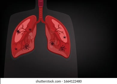 Covid-19 virus destroys lungs cell in a few time when goes inside a human body.