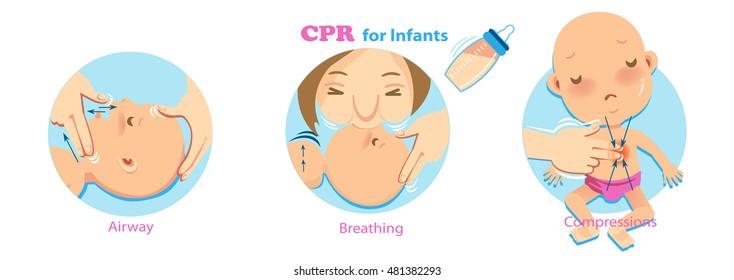 Cpr Infant Woman performing CPR.checking for signs of breathing. one hand compression.babies artificial respiration is done through infant's nose and mouth at the same time.