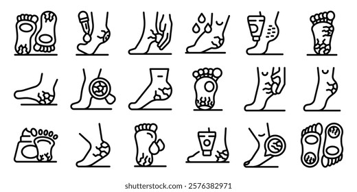 Cracked heels icons set. Cracked heels treatment applying moisturizing cream, using pumice stone and wearing silicone socks