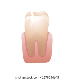 Cracked teeth of people caries tooth ill, dentist cabinet