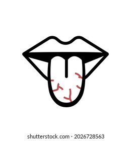 Cracked Tongue Icon. Xerostomia Medical Concept. Oral Disease Or Illness. Dehydration Sign. Oral Problem. Tongue’s Health Sign. Vector Illustration On White Background