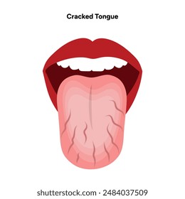 Cracked tongue problem and disease 