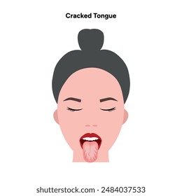 Cracked tongue problem in woman 