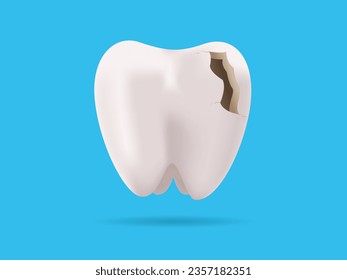 Diente roto. Ilustración vectorial 3D realista de dientes agrietados. atención odontológica