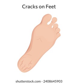 Cracks on feet vector illustration design.