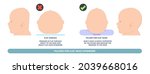 craniosynostosis helmet pillow flat head autism brain skull bone deformity baby infant child newborn defect birth anterior Metopic Born genes genetic position sleep shape deformation tummy time