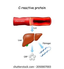 C-reactive Protein, And Pro-inflammatory Cytokine IL-6. Inflammation Of Blood Vessel. Liver Release Of Fibrinogen And CRP.