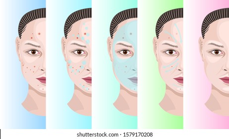 Cream for female face step by step cosmetic treatment acne. Woman face before and after. Realistic detailed vector illustration stock. 