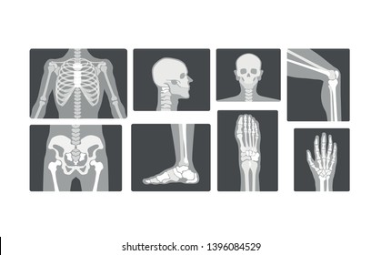 Creative Radiology Skeleton Bones Vector Realistic X-ray Logo Design Illustration