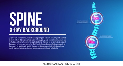 Creative vector illustration of spine x-ray, pain neck, disk degradation, injury treatment on background. Art design medical banner template. Abstract concept healthcare infographic graphic element