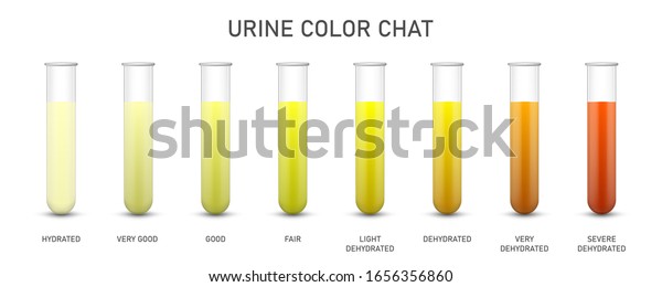 Creative Vector Illustration Urine Test Chat Stock Vector (Royalty Free ...