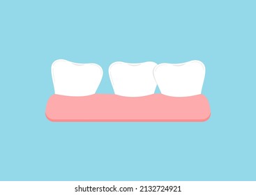 Crooked teeth in gym icon isolated. Dental crowding tooth for orthodontic bracket correction treatment. Vector flat design cartoon style dentistry misaligned illustration.