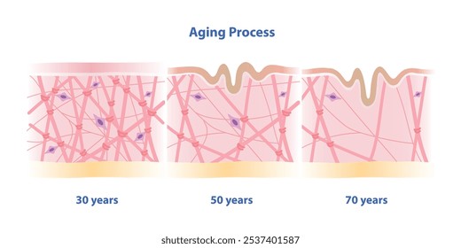 Seção transversal da ilustração do vetor de comparação da pele do processo de envelhecimento isolado no fundo branco. Alta densidade, depleção e baixa densidade de colágeno, fibras de elastina e fibroblastos na derme.