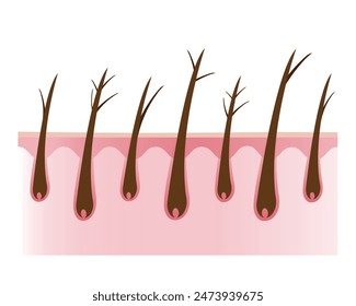 La sección transversal del cabello dañado y tipos de puntas abiertas con la Ilustración vectorial de la capa del cuero cabelludo aislada sobre fondo blanco. Sequedad, bebé partido, y partido y árbol. Cuidado del cabello y concepto de problema.