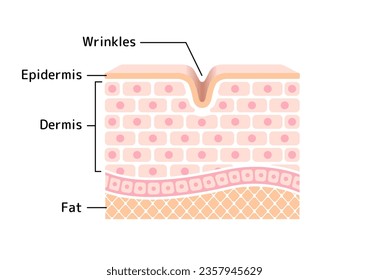 Cross section illustration of wrinkled skin