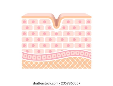 Cross section illustration of wrinkled skin