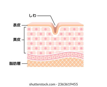 Cross section illustration of wrinkled skin. Translation: Wrinkles, Epidermis, Dermis, Fat