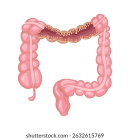 Cross section revealing the internal structure of the large intestine, featuring the ascending, transverse, descending, and sigmoid colons, rectum, and appendix