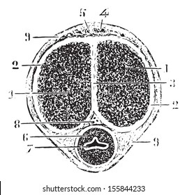 Cross section of the rod bone, vintage engraved illustration. Usual Medicine Dictionary by Dr Labarthe - 1885.