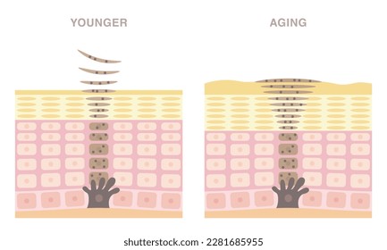 Cross section of skin cell turnover. Skin regeneration of younger and older. Older skin has spots.  Pale colored illustration in flat cartoon style.