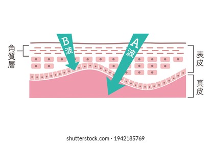 Cross section of the skin explaining ultraviolet A wave B wave. translation: kakushitsu-so means stratum corneum, A-ha B ha means UVA UVB, hyouhi means epidermis, shinpi means dermis.