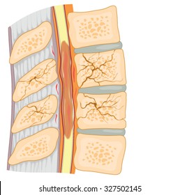 Cross Section Through Spinal Column Showing Stock Vector (Royalty Free ...