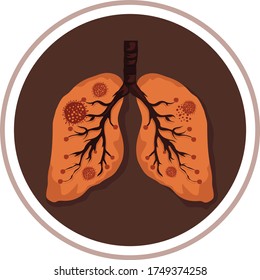 Vista cruzada de pulmones e infección de corona