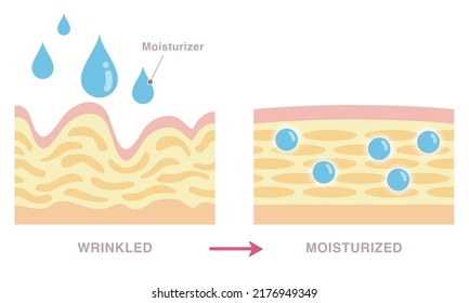 Cross Section Wrinkled Skin Moisturized Skin Stock Vector (Royalty Free ...