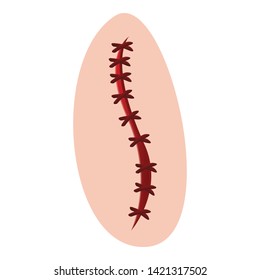Cross suture icon. Cartoon of cross suture vector icon for web design isolated on white background