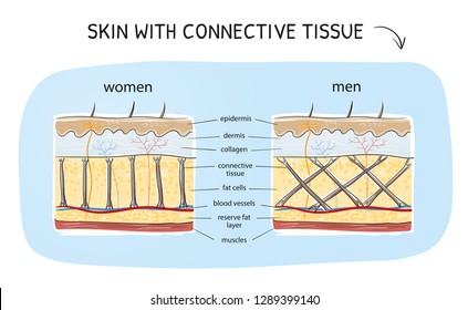 Cross-section View Of A Human Skin With Comparison Of Connective Tissue Of Men And Women. Medical Info Graphics. Hand Drawn Cartoon Sketch Vector Illustration, Marker Style Coloring.  