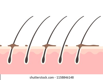 Cross-sectional view of the scalp and dirt