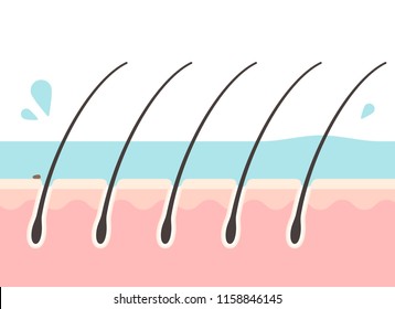 Cross-sectional view of the scalp during rinsing